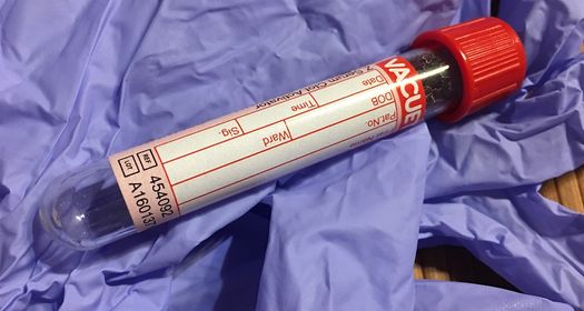 Диета по группе крови Диета по группе крови